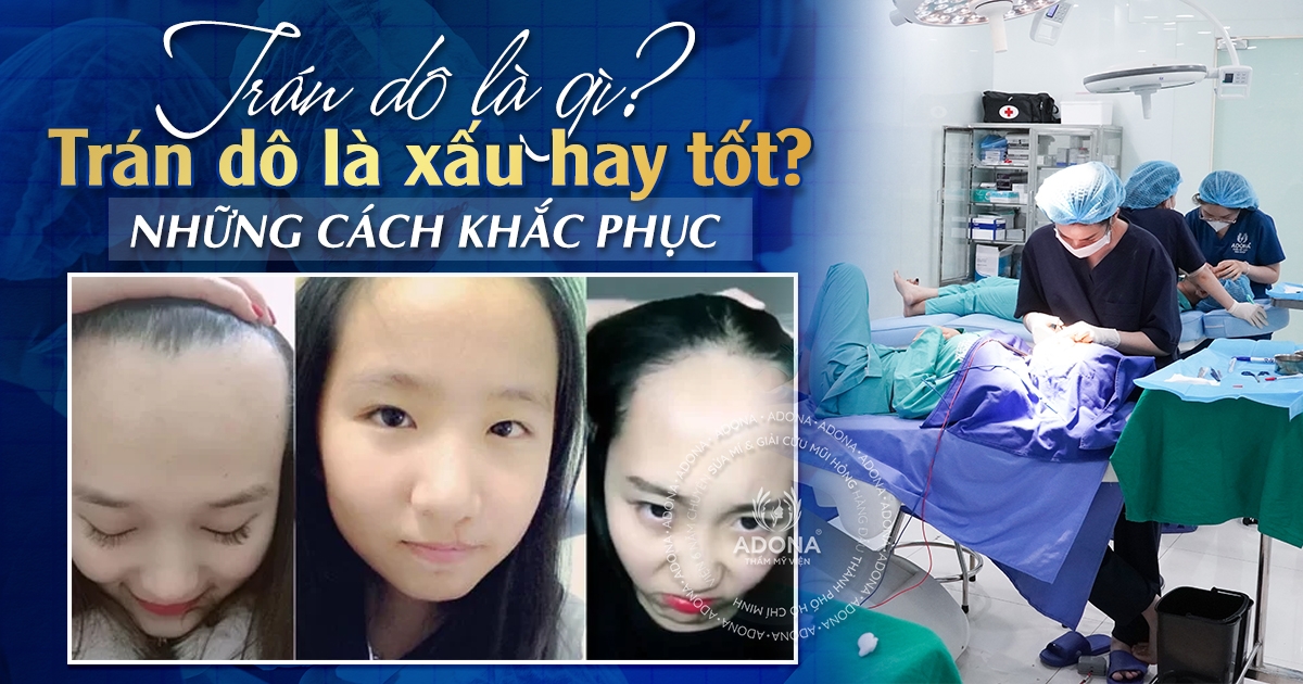 Trán dô là gì? Trán dô là xấu hay tốt? Những cách khắc phục - THẨM MỸ ...
