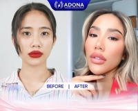 hot tiktoker Vy Phạm tại ADONA