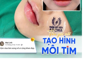 Tạo hình môi trái tim tại TP.HCM