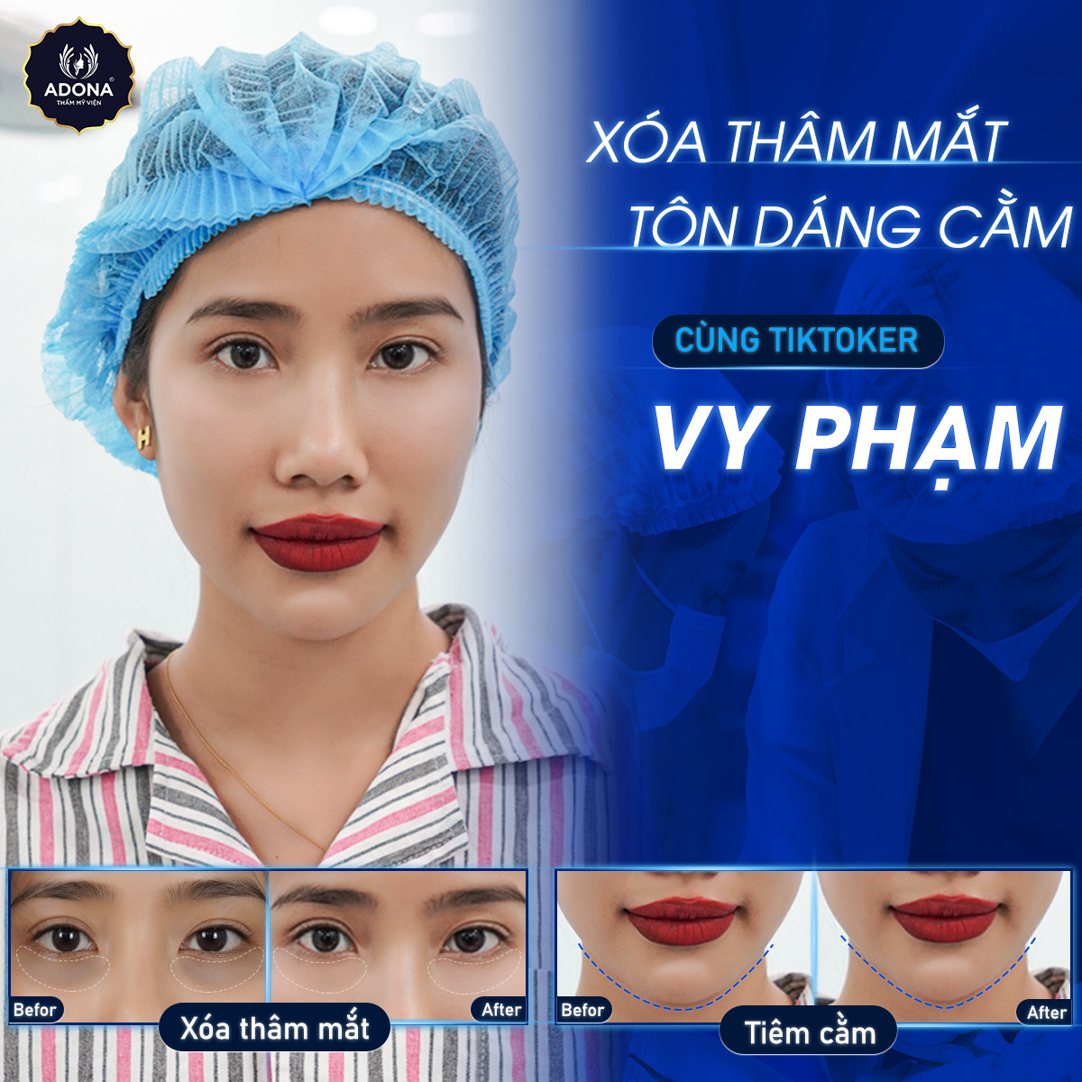 CÔNG TY TNHH ADONA