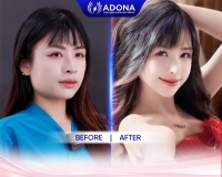 Hot Tiktoker Pinky Vanh tại ADONA