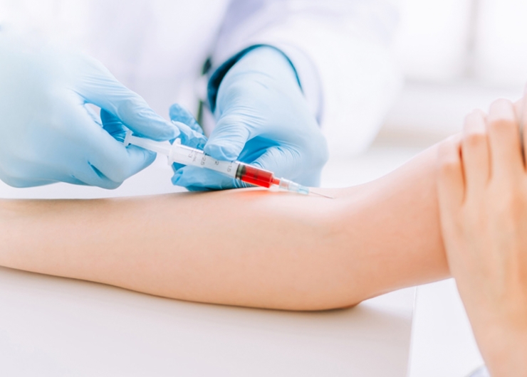 XÉT NGHIỆM TỔNG KHÁT